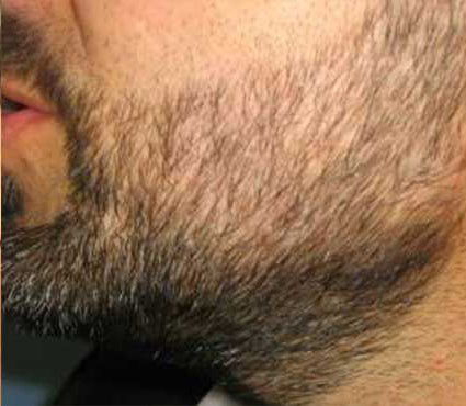 <em><strong>Oscar P.</strong></em>